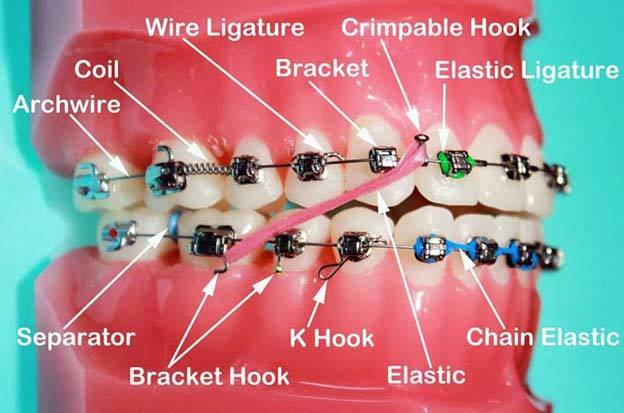Transforming Smiles: The Journey of Orthodontic Treatment in India