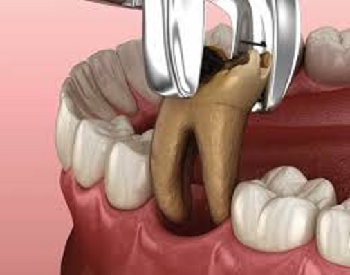Relief from Pain: How Modern Oral and Dental Clinics are Transforming Lives