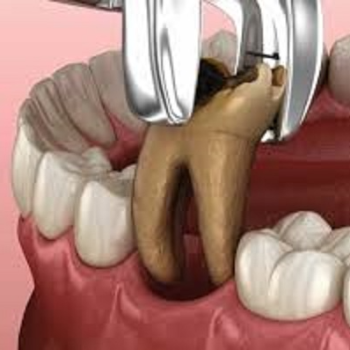 MODERN ORAL AND DENTAL CLINIC - Best Dental Clinic in Bikramganj, Bihar – Your Smile Deserves Expert Care in Bikramganj