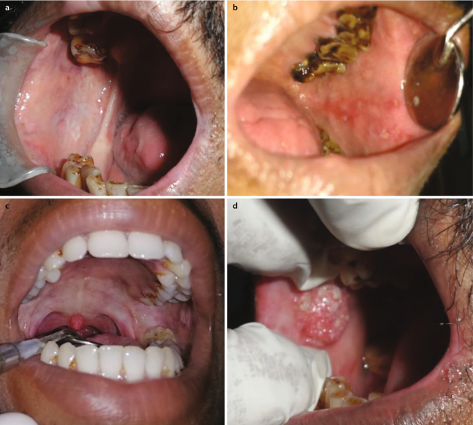Understanding OSMF