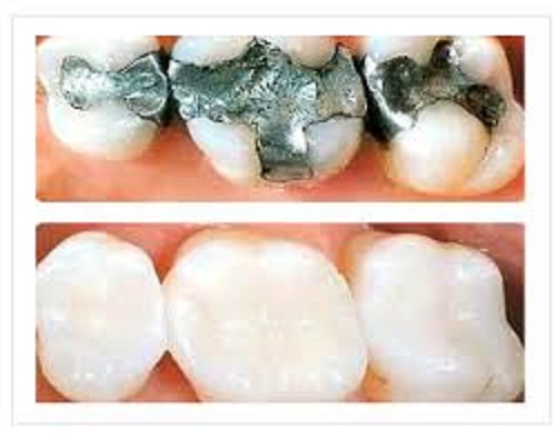 Transforming Smiles and Lives: How Modern Dental Restoration Changes Everything