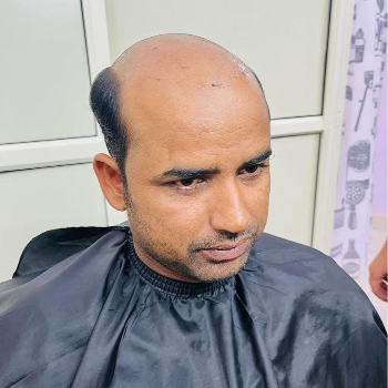HAIR ZONE - Gallery in Gurugram
