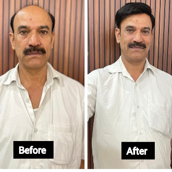 HAIR ZONE - Gallery in Gurugram