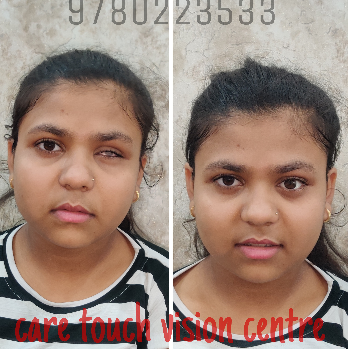 CARE TOUCH VISION CENTRE - Gallery in Lucknow