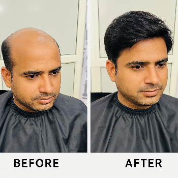 HAIR ZONE - Gallery in Gurugram