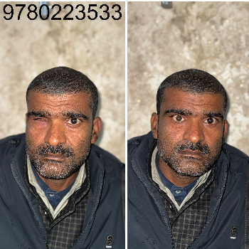 Custom Artificial Eye Prosthetic - Natural Look - Image 5