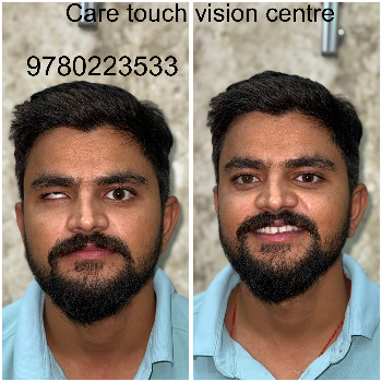Custom Artificial Eye Prosthetic - Natural Look - Image 15