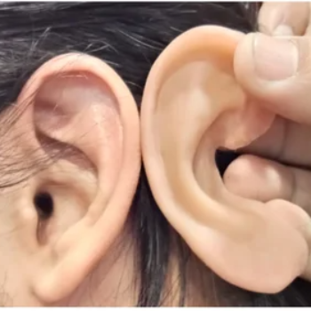 Ear prosthesis in Lucknow — CARE TOUCH VISION CENTRE