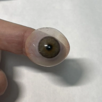 Thin Scleral shell in Lucknow — CARE TOUCH VISION CENTRE