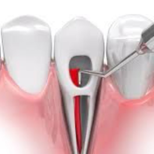 Root Canal Treatment — Kopar Khairane, Navi Mumbai