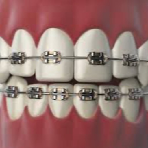 Braces (Orthodontic Treatment) — Kopar Khairane in NAVI