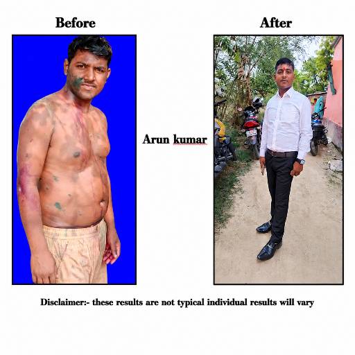 Skin Transformation Service in Patna | Radiant Skin in