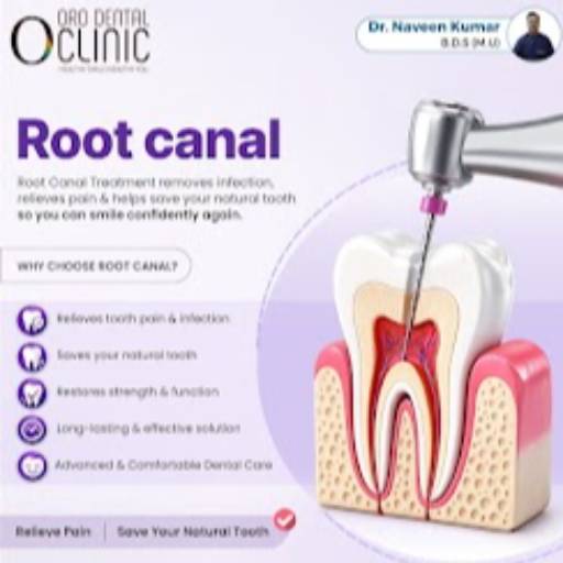 ORO DENTAL CLINIC - Root Canal Dental Service in Oro Dental Clinic | Expert in JAHANGIRPURI