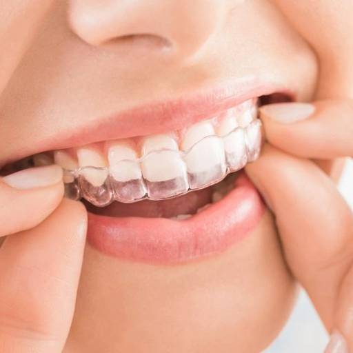 RISHABH RAMESH PENDURKAR - Invisalign in Wadala, Mumbai in MUMBAI
