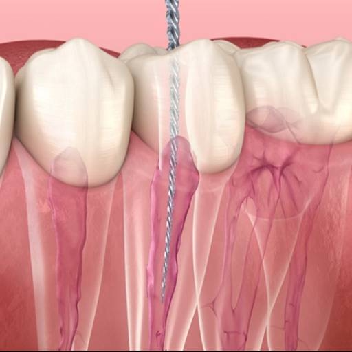 RISHABH RAMESH PENDURKAR - Root Canal Treatment in Wadala, Mumbai in MUMBAI