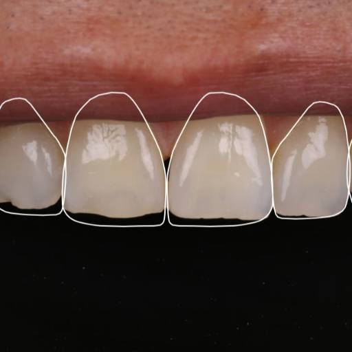 RISHABH RAMESH PENDURKAR - Smile Design and Veneers in Wadala, Mumbai in MUMBAI