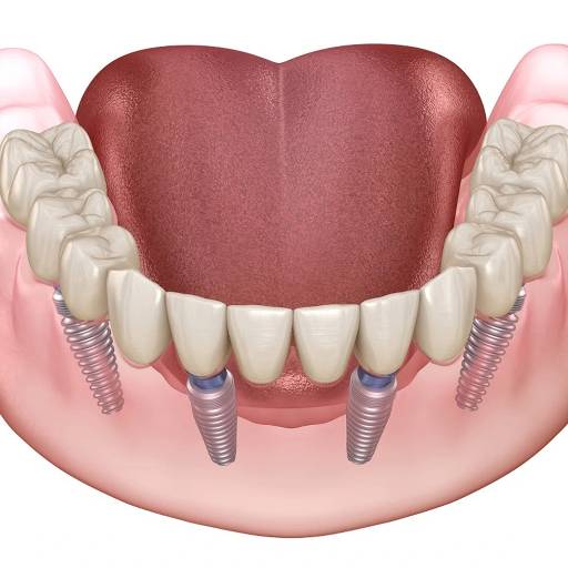 RISHABH RAMESH PENDURKAR - Dental Implants in Wadala, Mumbai in MUMBAI