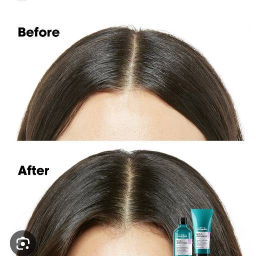KOREAN FAMILY SALON - Scalp Advance Treatment in BANGALORE