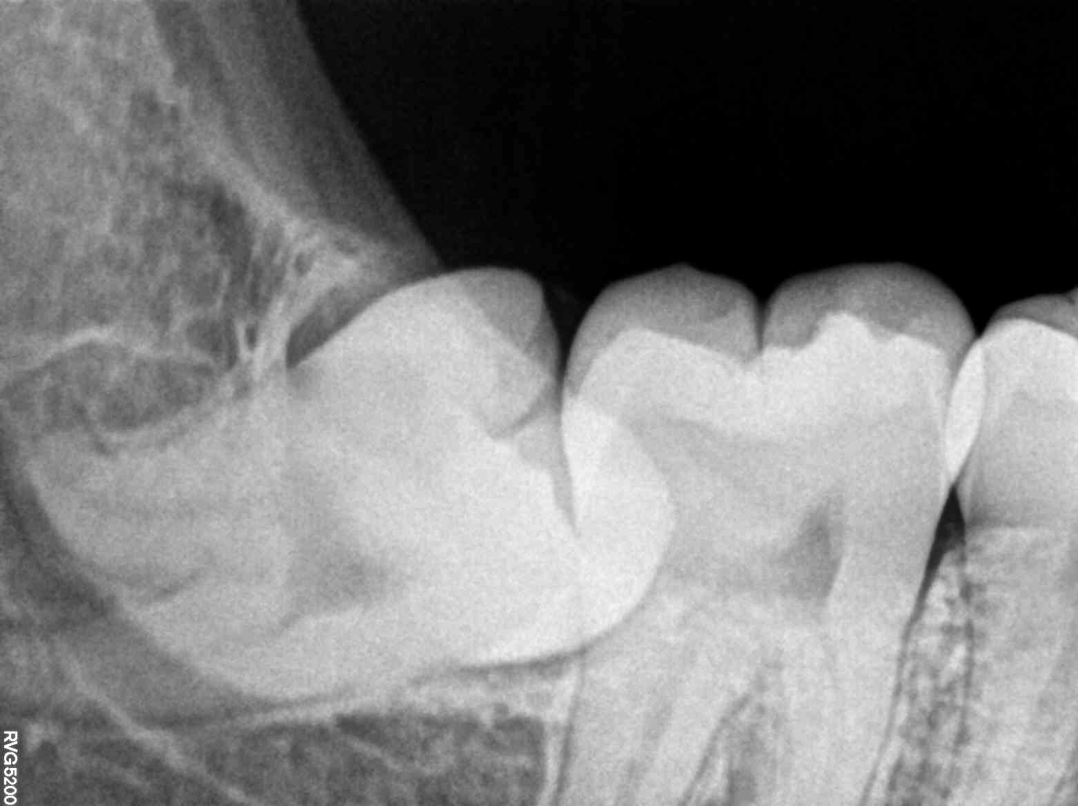 MODERN ORAL AND DENTAL CLINIC - X-ray in Bikramganj — MODERN ORAL AND DENTAL CLINIC in Bikramganj